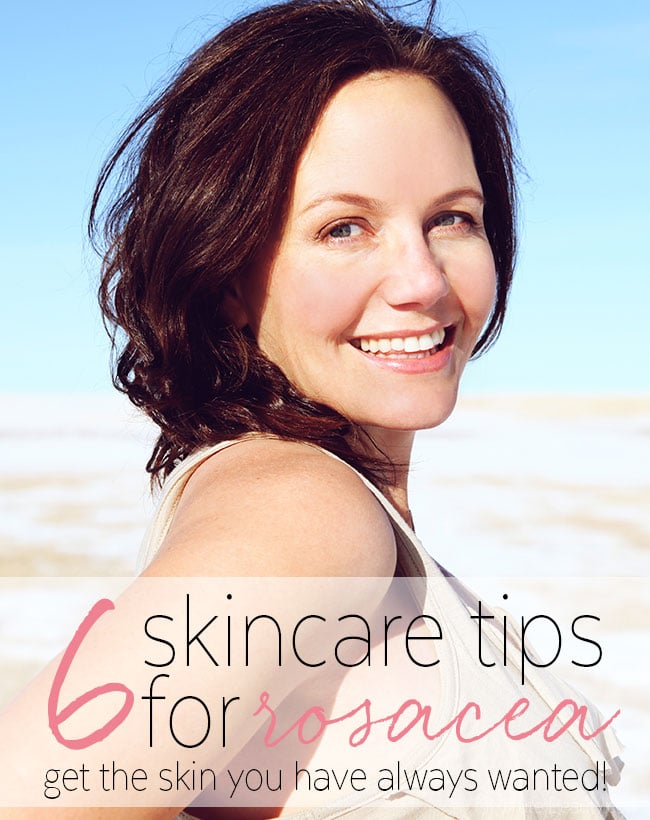 Easy Skincare Tips for Rosacea