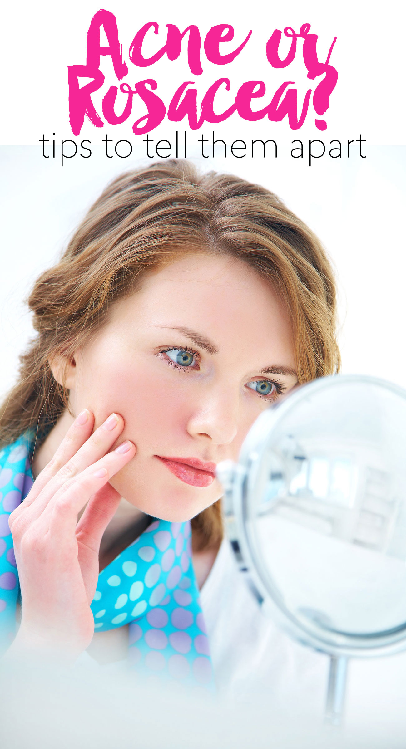 Do you have adult acne or rosacea?