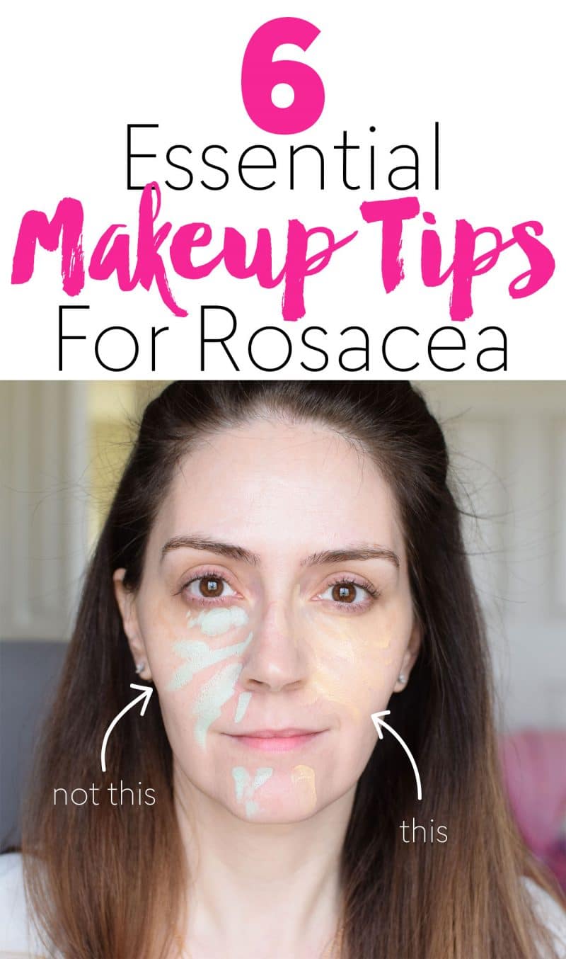 red face makeup tips for rosacea sufferers