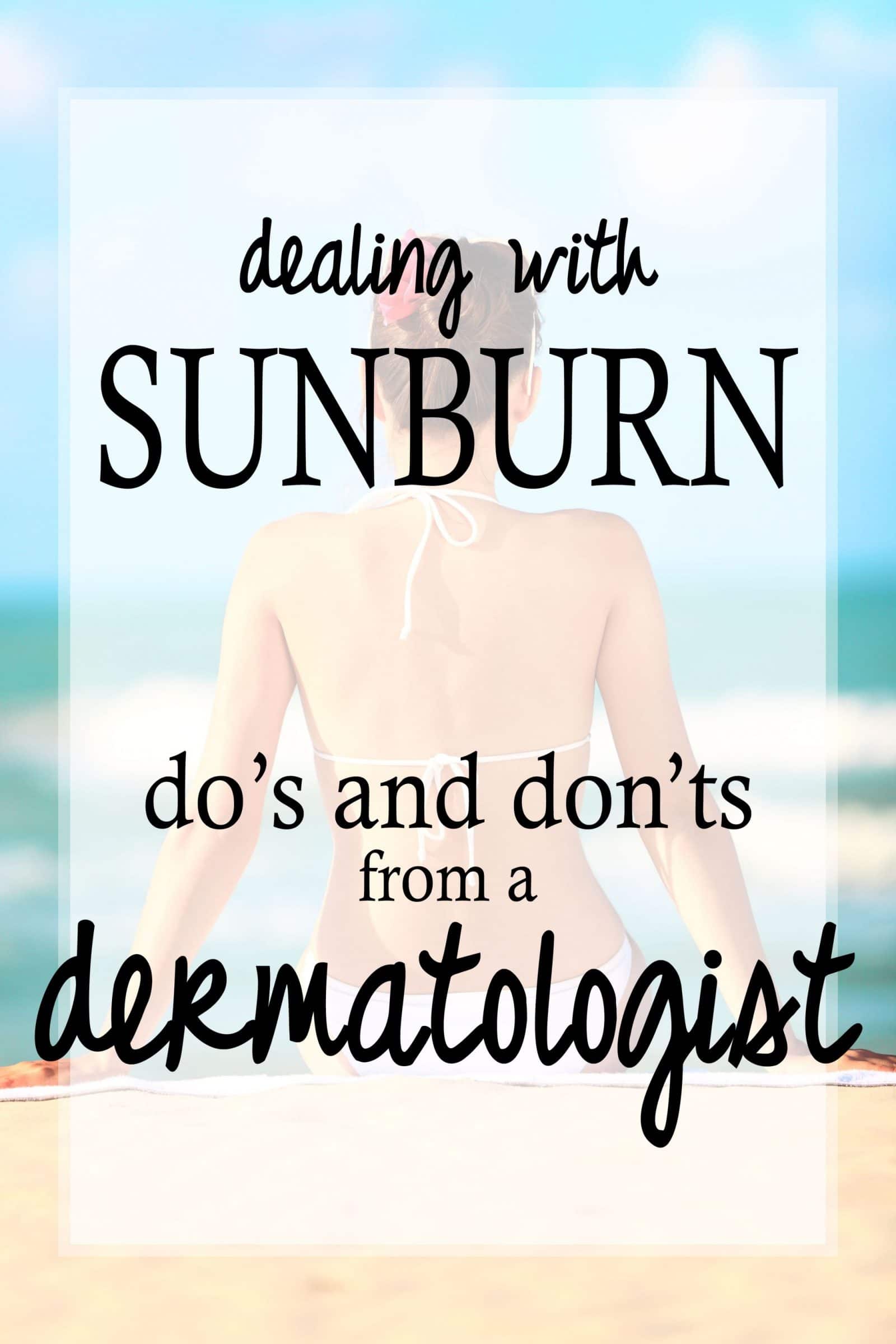 Dermatologist tips for sunburn